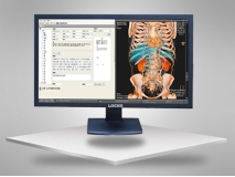 LOCUS专业医用液晶系列显示器